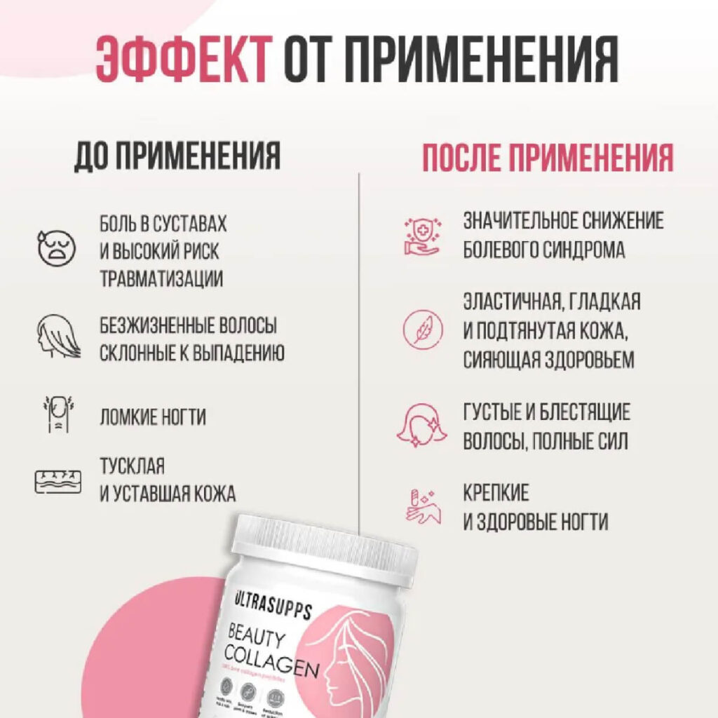 Бьюти коллаген пептиды, 150 г, Ultrasupps